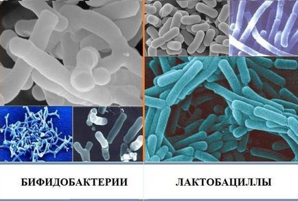 Care sunt bifidobacterii și lactobacili