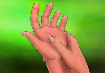 Ce să faci când obzhog cu degetul