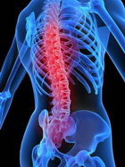 Ce este osteoporoza osoasă