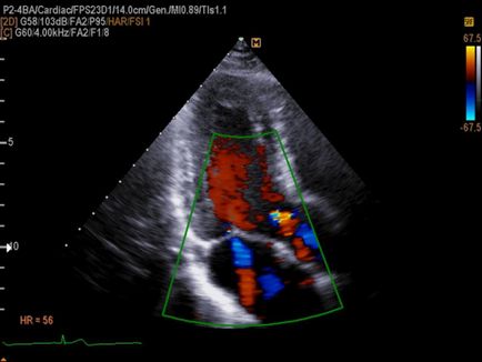 Metode de diagnosticare functionala