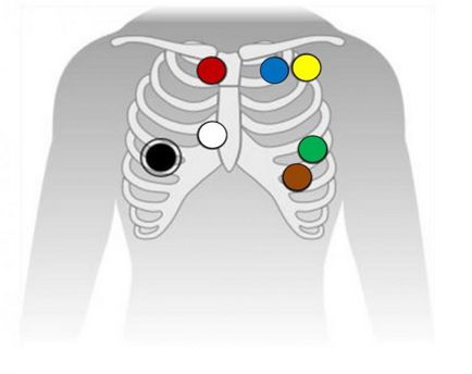 Metode de diagnosticare functionala