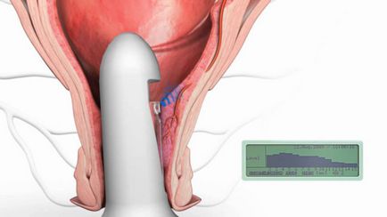 Cum gadget-uri Cum gadget-uri