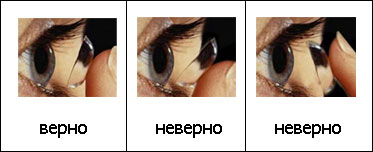 Cum se introduce lentila in ochi