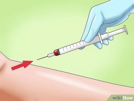 Cum să vă o injecție intravenoasă face