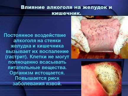 Cure alcoolism acasă Cure alcoolism acasă