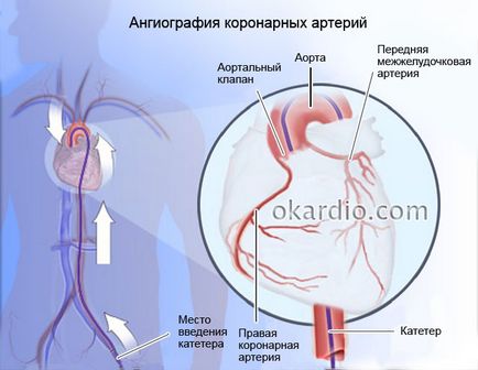 contraindicații coronariene