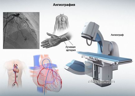 contraindicații coronariene