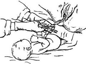 Cum de a lega cordonul ombilical