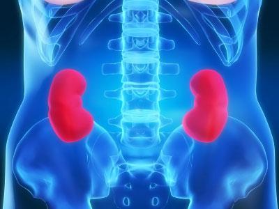Acesta a extins pelvisului renal la fel de înfricoșător