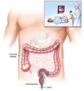 Diagnosticul a intestinului subtire