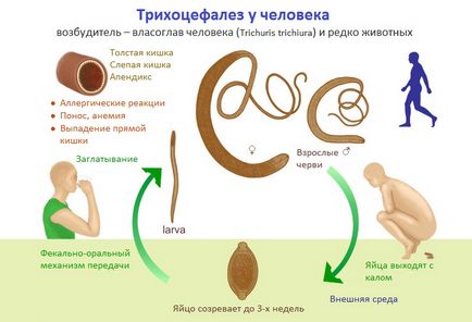 Trichocephalosis-l