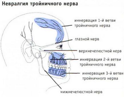 remedii populare trigemen tratament nervoase