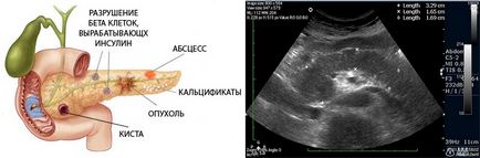 Uzi organele interne,