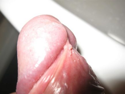 HPV la barbati