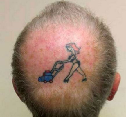 5 motive pentru aspectul de chel patch-uri pe frunte de bărbați și 2 moduri de a face cu ei - haircutmen