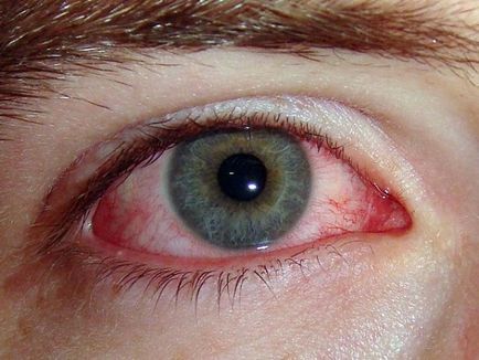 Simptome Alergii Sphynx și tratament
