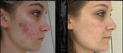 Diamant de slefuire caracteristici feței și rezultatele procedurii