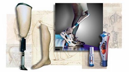 reabilitarea amputarea piciorului, efecte posibile