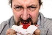 Clåtirea gura dupa o interventie chirurgicala pentru a elimina un dinte
