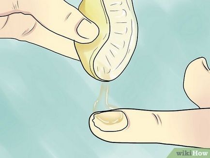 Cum sa scapi de unghii ciuperca