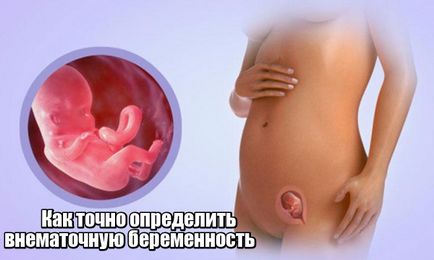 Cum de a identifica o sarcina extrauterina în stadii incipiente de diagnostic și de detectare în stadii incipiente