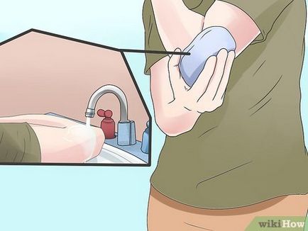 Cum să te îmbraci rana