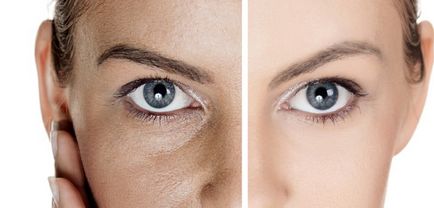 Cum să se alinieze regulile de nivelare fața și pielea