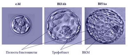 Cultivarea embrionilor - care este o fotografie și video