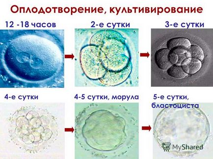 Cultivarea embrionilor - care este o fotografie și video