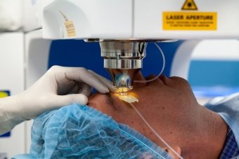 Chirurgia laser pentru ochi, în care beneficiile sale