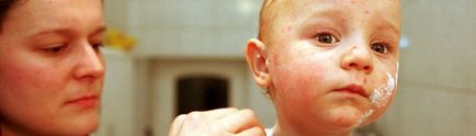Pot să fac baie copilului cu varicela atunci când se poate scălda copilul dupa varicela