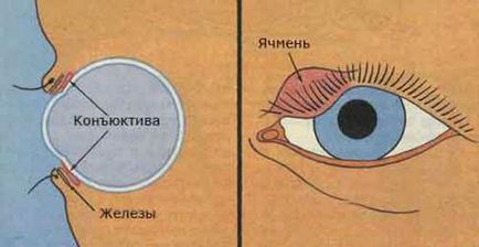 Ochii pleoapei superioare Umflarea ce să facă, cum să trateze și cum să evite
