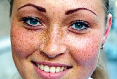 Albirea măști faciale la un efect de frumusete acasă rapid, fără izyanov (persoană) Albirea masti faciale la un efect de frumusete acasă rapid, fără izyanov