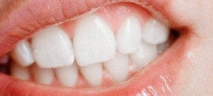 De ce dintii mancarime si gingiile sunt un adult sau un adolescent