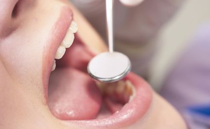 De ce dintii senzația de mâncărime vitaportal - Sanatate si Medicina