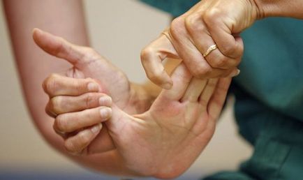 De ce se umflă braț sau picior după un accident vascular cerebral cauze si tratament
