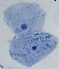 celulă procariotă - organism de celule pre-nuclear