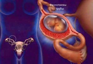 Ruperea ovar, cauzele și simptomele, posibilele consecințe și complicații