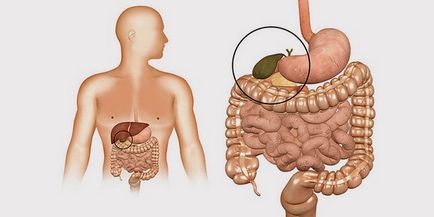 Simptomele de stagnare a bilei din vezica biliară și cauzele bolii