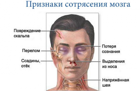 simptome comotie, consecințe, tratament