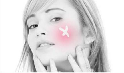 Tetraciclina unguent acnee reguli de bază de utilizare