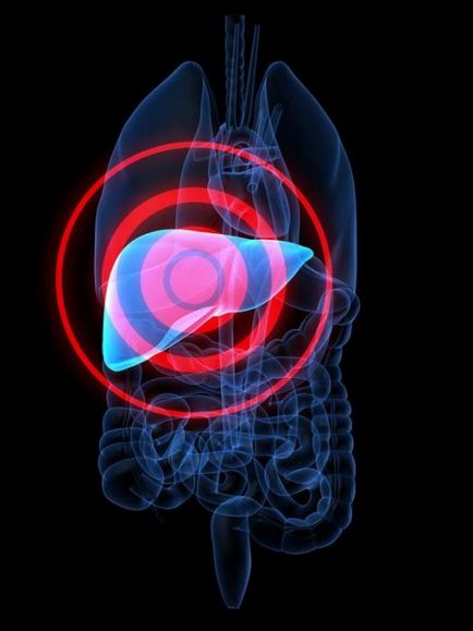 ficat gras cauze, simptome și tratament
