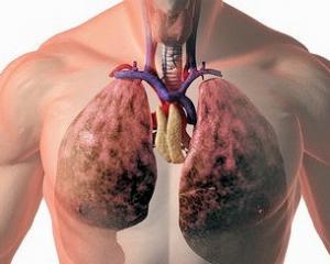 Lung abcesele ce este