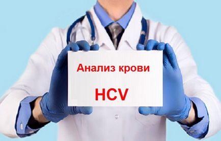 Un test de sange HVC cum este de a transmite hepatita C, câte zile este numele