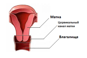 Însămânțarea canalului cervical care este