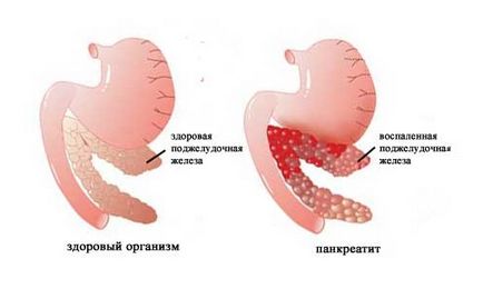 Din ceea ce trage partea dreapta