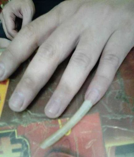 De ce cresc o unghie pe degetul mic