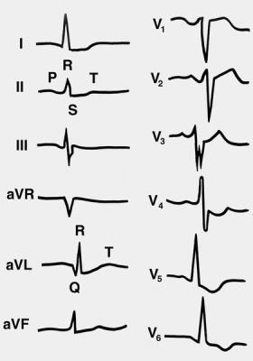 kg Echo ale inimii (ecocardiografie) ce este, în cazul în care aceștia își petrec și ceea ce este prețul