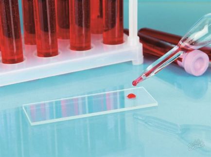 test de sânge HVC ce este