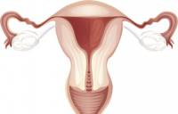 Cum de a restabili uterului